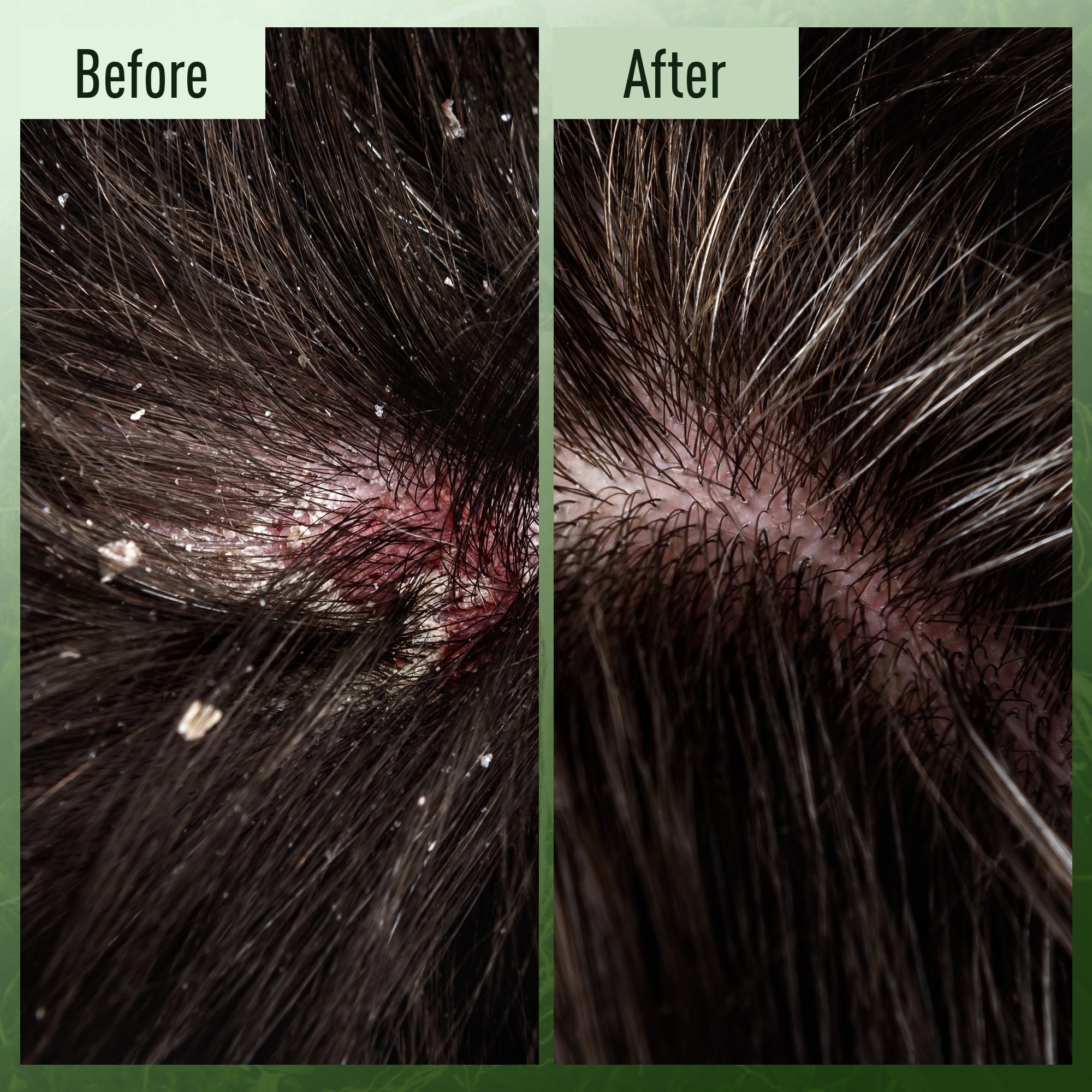 ABERA High-Performance Anti-Dandruff Shampoo with Langbian Ginseng Extract